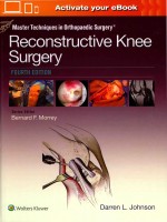 MASTER TECHNIQUES IN ORTHOPAEDIC SURGERY RECONSTRUCTIVE KNEE SURGERY FOURTH EDITION