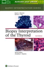 BIOPSY INTERPRETATION SERIES BIOPSY INTERPRETATION OF THE THYROID SECOND EDITION