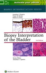 BIOPSY INTERPRETATION SERIES BIOPSY INTERPRETATION OF THE BLADDER THIRD EDITION