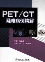 PET/CT疑难病例精解