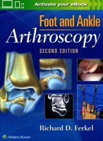 FOOT AND ANKLE ARTHROSCOPY SECOND EDITION