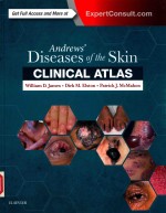 ANDREWS' DISEASES OF THE SKIN CLINICAL ATLAS