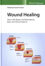 Wound Healing: Stem Cells Repair and Restorations