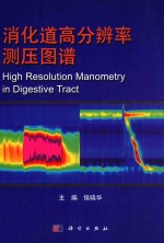 消化道高分辨率测压图谱