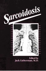 Sarcoidosis