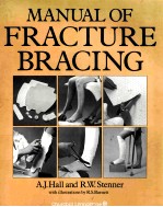 manual of fracture Bracing