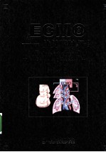 体外膜肺支持（ECMO）