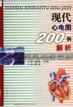 现代心电图200例解析