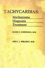 Tachycardias--mechanisms