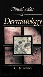 Clinical Atlas of Dermatology