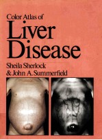 Color Atlas of Liver Disease