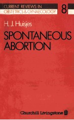 Spontaneous abortion