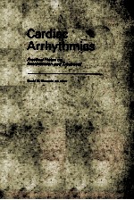 Cardiac arrhythmias