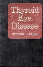 Thyroid eye disease.