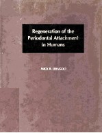 Regeneration of the Periosontal Attachment in Humans.