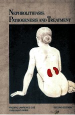 Nephrolithiasis: PATHOGENESIS AND TREATMENT