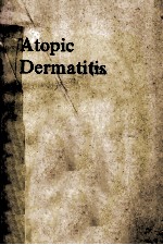 Atopic dermatitis