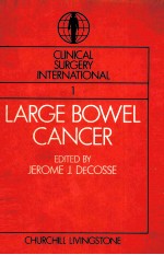 Large Bowel Cancer