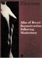 Atlas of breast reconstruction following mastectomy