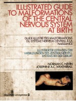 Illustrated guide to malformations of the central nervous system at birth = Guide illustré des malfo