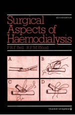 Surgical Aspects of Haemodialysis