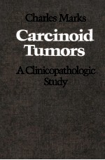 Carcinoid tumors