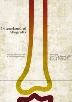 Osteochondral Allografts