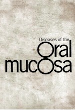 DISEASES OF THE ORAL MUCOSA  DIAGNOSIS