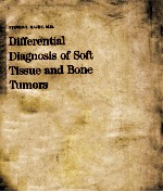 Differential diagnosis of soft tissue and bone tumors