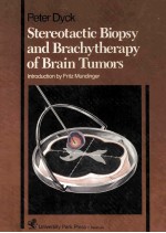 Stereotactic biopsy and brachytherapy of brain tumors