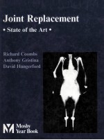 JOINT REPLACEMENT:STATE OF THE ART