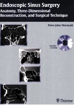 ENDOSCOPIC SINUS SURGERY ANATOMY