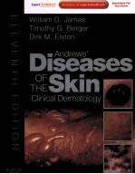 ANDREWS'DISEASES OF THE SKIN CLINICAL DERMATOLOGY