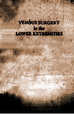 Venous surgery in the lower extremities