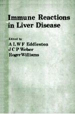 Immune reactions in liver disease