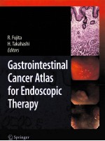 GASTROINTESTINAL CANCER ATLAS FOR ENDOSCOIC THERAPY