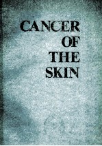 Cancer of the skin