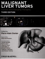 MALIGNANT LIVER TUMORS CURRENT AND EMERGING THERAPIES THIRD EDITION