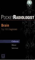 POCKETRADIOLOGISTTM BRAIN 100 TOP DIAGNOSES