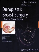 ONCOPLASTIC BREAST SURGERY A GUIDE TO CLINICAL PRACTICE