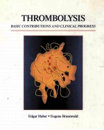 Thrombolysis