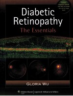 DIABETIC RETINOPATHY:THE ESSENTIALS