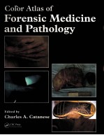 COLOR ATLAS OF FORENSIC MEDICINE AND PATHOLOGY