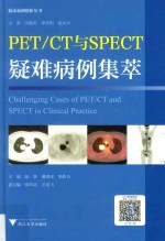 PET/CT与SPECT疑难病例集萃  临床精析病例集锦