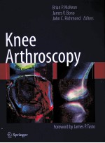 KNEE ARTHROSCOPY