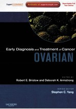 Ovarian Cancer