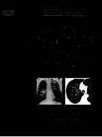 IMAGING OF THE DISEASES OF THE CHEST FOURTH EDITION