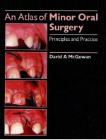 AN ATLAS OF MINOR ORAL SURGERY