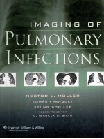 IMAGING OF PULMONARY INFECTINS