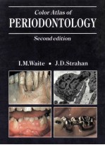 COLOR ATLAS OF PERIODONTOLOGY  SECOND EDITION